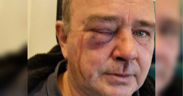 Мобілізація з кулаками: після вручення повістки невідомі побили водія під Києвом, поліція порушила справу (фото, відео) - INFBusiness