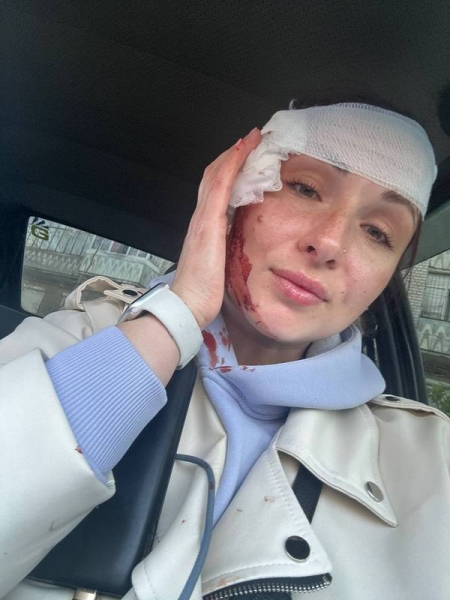 "Болю спочатку не відчула, мабуть, була на страшному адреналіні", - пригадує Кіра Овес 1