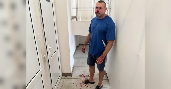 Бажав смерті військовим ЗСУ: скандально відомий фітнес-тренер з Одеси вирушив на фронт до «азовців» - INFBusiness