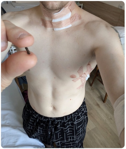 Журналіст, колишній політв'язень Кремля та чинний військовий Станіслав Асєєв отримав поранення на фронті. Про це він повідомив у соцмережі Х. 1