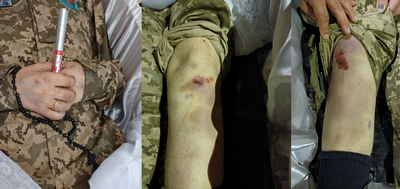 «На тілі синці, побої, губа розбита»: рідні не вірять у версію смерті бійця через хворобу й переконані, що його жорстоко побили - INFBusiness