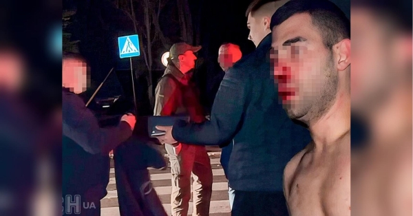 Лікарняним ліжком закінчилася зустріч з дівчиною для молодого киянина. 2 листопада ввечері пара закоханих відпочивала в дорогому ресторані «Shade», що на вулиці Пилипа Орлика. Звідти хлопця забрала «швидка». Лікарі діагностували в нього струс головного мозку, зламаний ніс, крововилив у нирки, інші тілесні ушкодження. Кайданки для «Саші Браслєта» і його дружка-поліціянта, які чіплялися до дівчини в ресторані й побили її хлопця: деталі гучного скандалу в Полтаві - INFBusiness