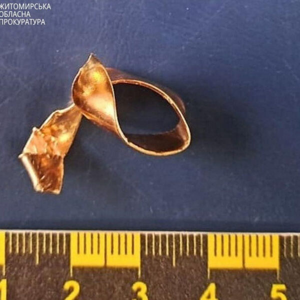 Відірвав палець плоскогубцями: працівника моргу в Житомирській області засудили за&hellip;