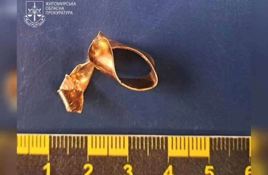 Відірвав палець плоскогубцями: працівника моргу в Житомирській області засудили за&hellip;