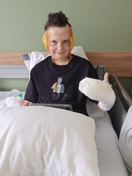 Для Ромчика ця операція, що тривала дев'ять годин, стала 36-ю в цілому і першою, зробленою в Україні Ромчик, що дивом уцілів після російського ракетного удару по Вінниці, нарешті скинув маску, яку носив два роки: хлопчику хірурги також відновили вуха. - INFBusiness