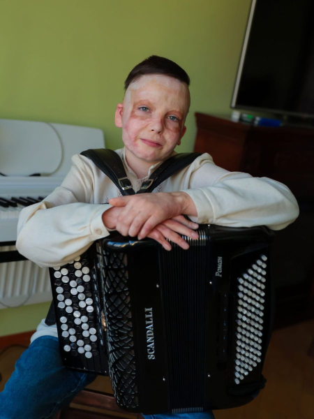 " Якби не баян, синові довелося б ходити на спеціальну терапію, а так ми поєднали реабілітацію з естетичним задоволенням", - розповідає батько Ромчика Ромчик, що дивом уцілів після російського ракетного удару по Вінниці, нарешті скинув маску, яку носив два роки: хлопчику хірурги також відновили вуха. - INFBusiness