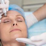 Пластика повік: все про операцію - кому, як роблять, реабілітація - INFBusiness