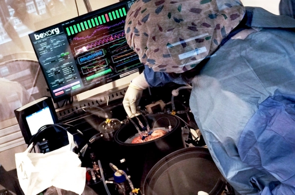 American startup revives dead brains for drug testing Reddit stunned