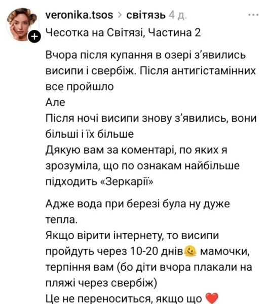 Після відпочинку на Шацьких озерах з'явився висип на шкірі – що відбувається на популярному курорті 9