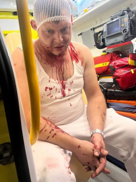 У Польщі стався новий напад на трьох українців, поліція почала розслідування - ЗМІ 6