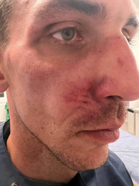 У Польщі стався новий напад на трьох українців, поліція почала розслідування - ЗМІ 10
