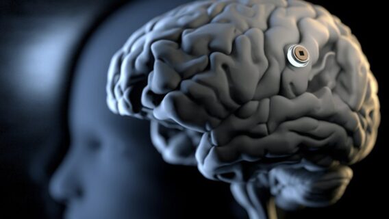 Китайський стартап випробував 10-хвилинний мозковий імплант, що конкурує з Neuralink