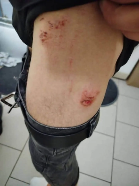 У Польщі стався новий напад на трьох українців, поліція почала розслідування - ЗМІ 7