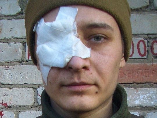 Лікар-окупант доручив студенту операцію на оці українського полоненого