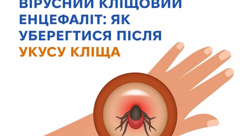Харківські лікарі: прості правила захисту від кліщового енцефаліту після укусу